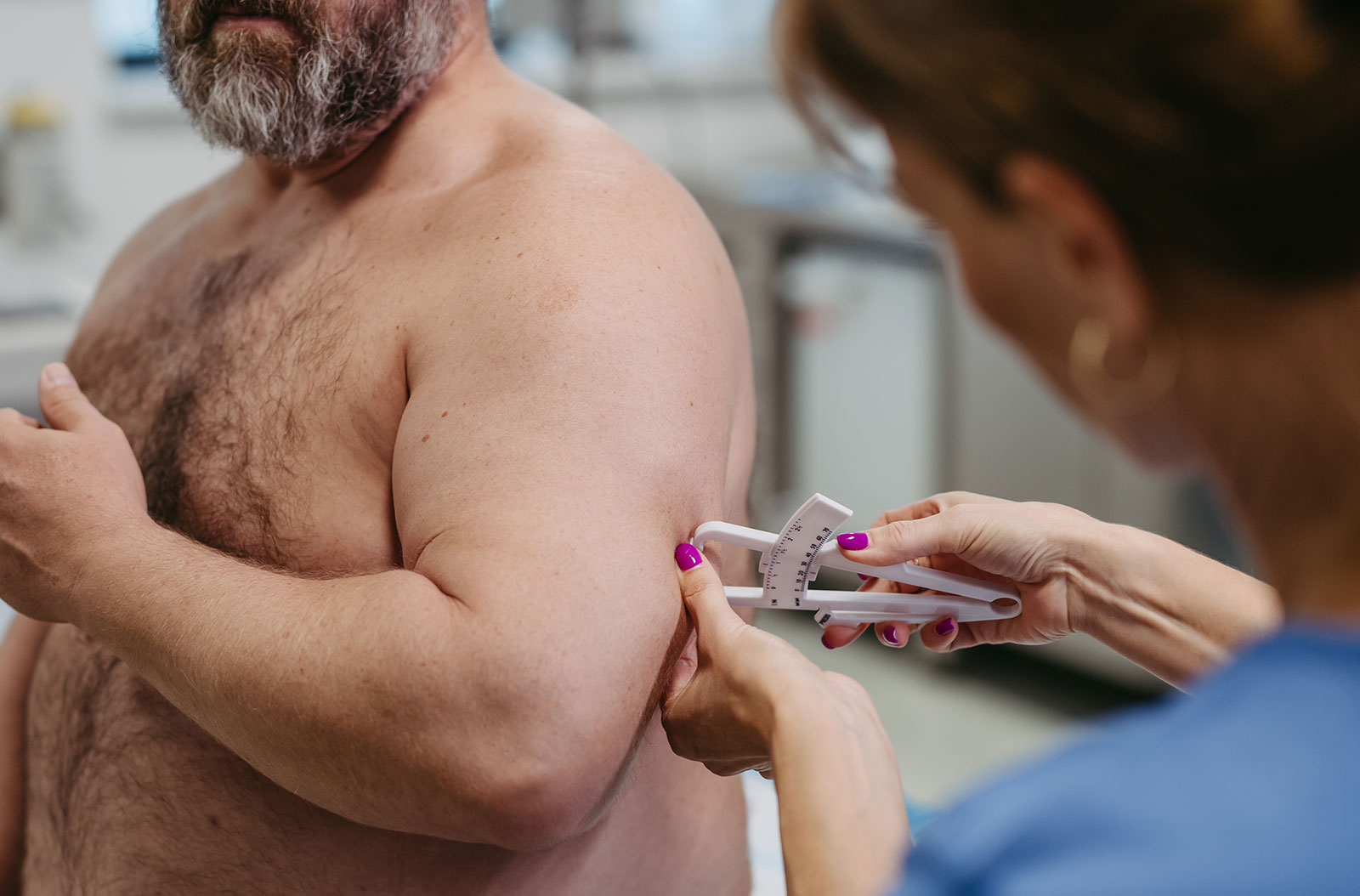 Evaluaciones médicas previas a la cirugía de bypass gástrico. Pruebas necesarias antes de ser aprobado para el procedimiento