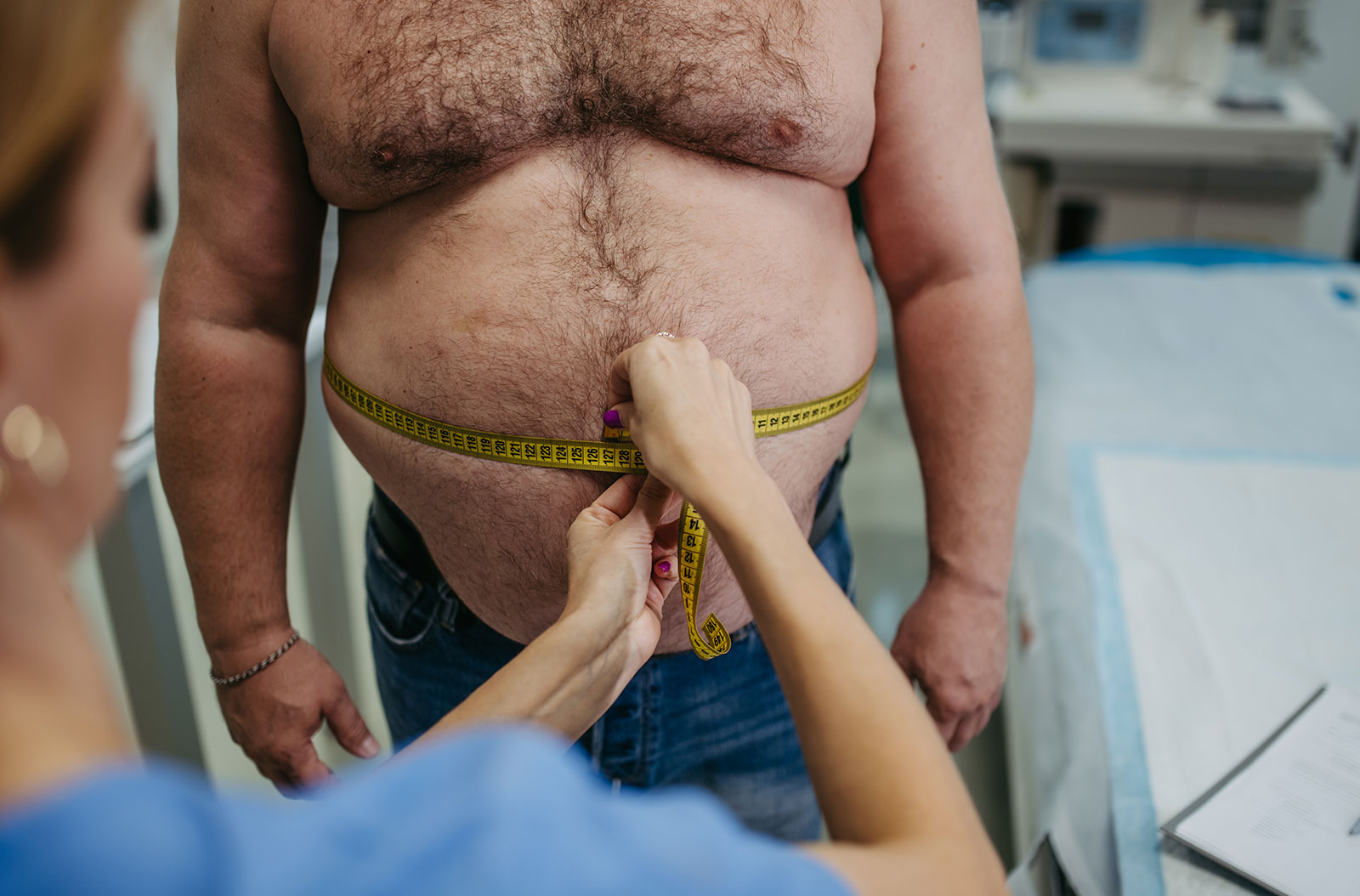 ¿Quién es apto para un bypass gástrico? Requisitos generales para ser candidato a la cirugía